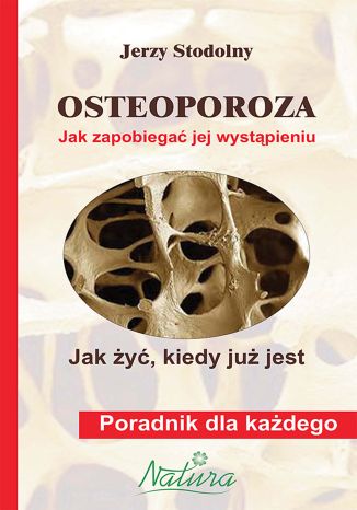 Osteoporoza. Jak zapobiegać jej wystąpieniu, jak żyć, kiedy już jest